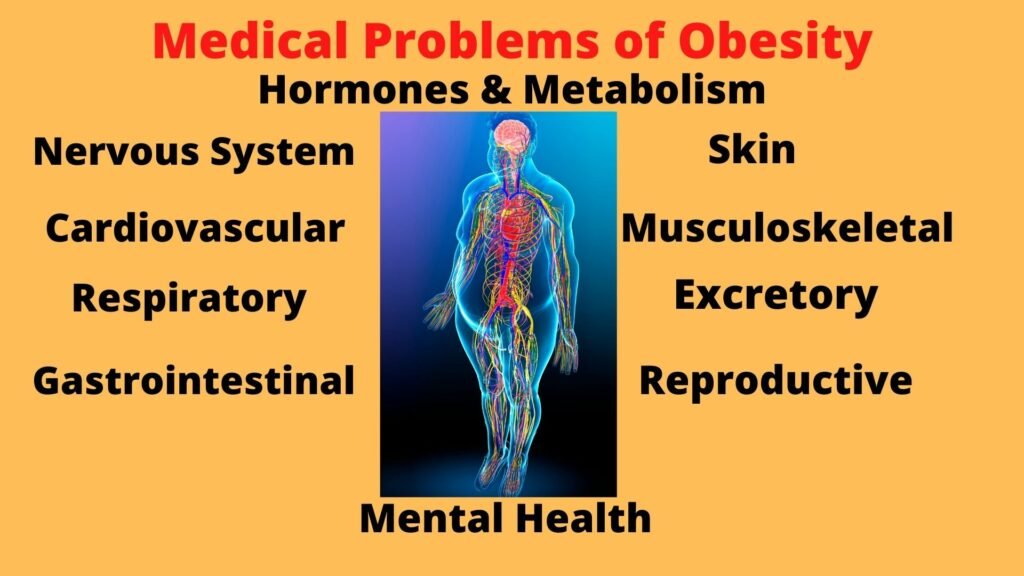 Childhood Obesity Health Problems