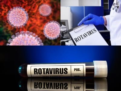 rotavirus vaccines
